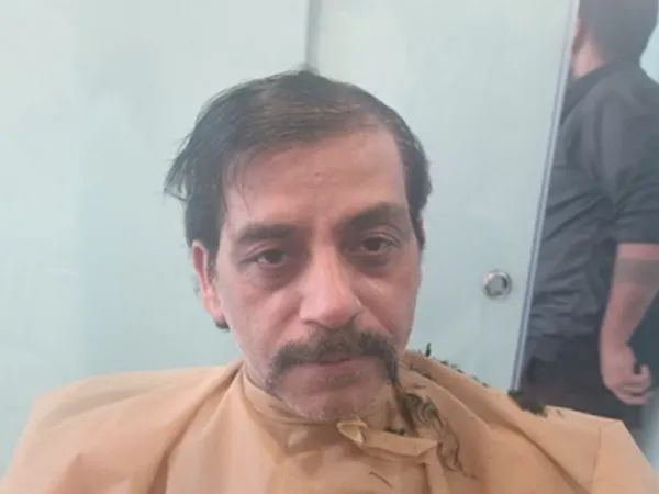 Client-1 - Before