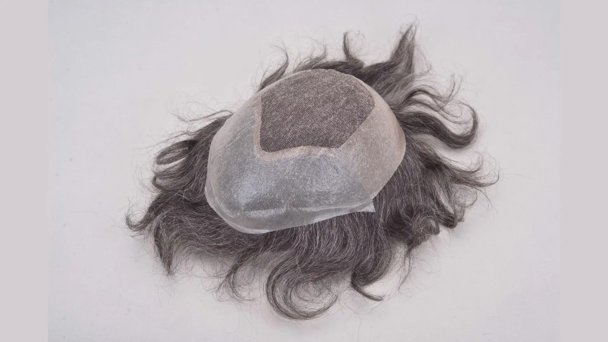 Best Hair Patch in Delhi | Non-Surgical Hair Patch Service